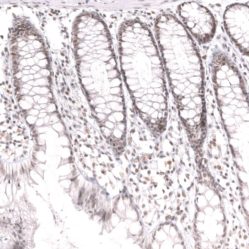 Staining of human rectum shows moderate nuclear positivity in glandular cells and lymphoid cells.