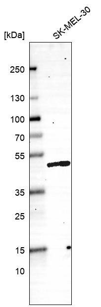 Western blot analysis in human cell line SK-MEL-30.