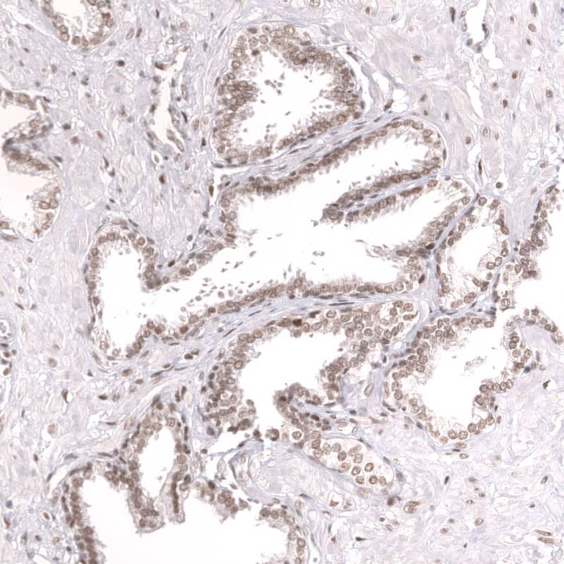 Staining of human prostate shows moderate nuclear positivity in glandular cells.