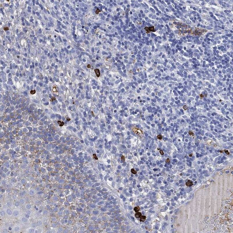 Staining of human tonsil shows cytoplasmic positivity in non-germinal center cells.