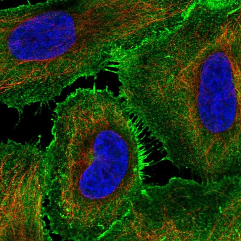 Staining of human cell line HeLa shows localization to plasma membrane.