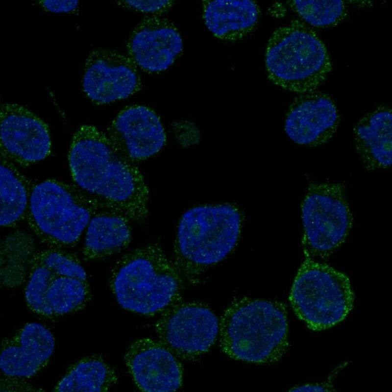 Staining of human cell line REH shows localization to plasma membrane.