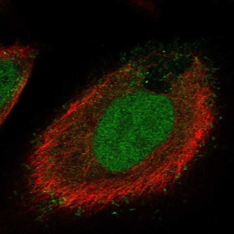 Staining of human cell line PC-3 shows localization to nucleoplasm & plasma membrane.