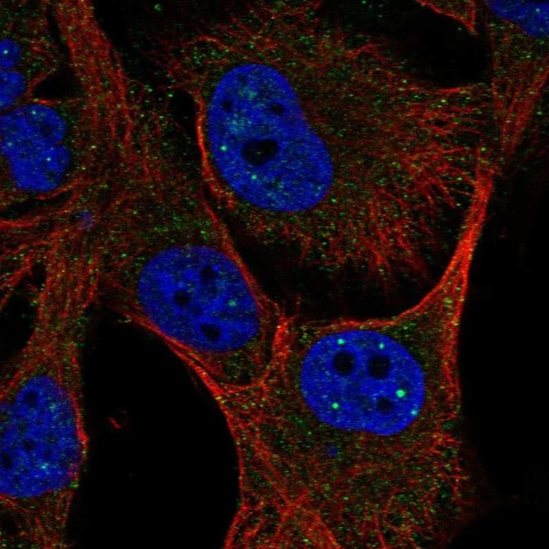 Staining of human cell line SK-MEL-30 shows localization to nuclear bodies.