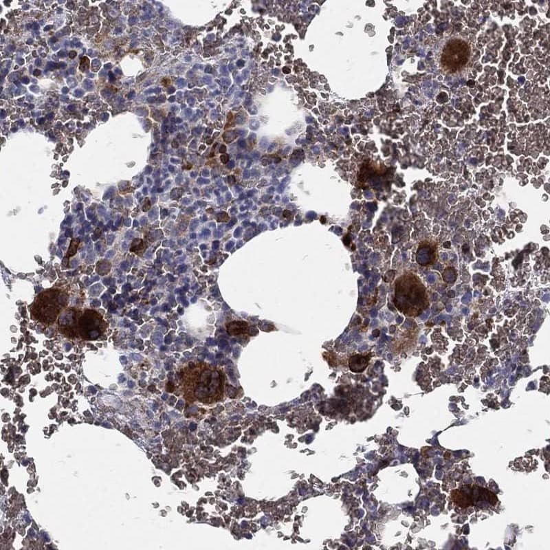 Immunohistochemistry-Paraffin Cathepsin W Antibody