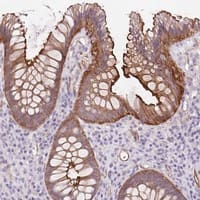 Staining of human rectum shows strong membranous and cytoplasmic positivity in glandular cells.