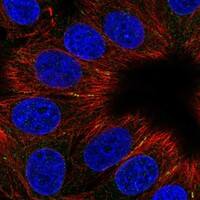Immunocytochemistry/ Immunofluorescence CCDC88C Antibody - BSA Free