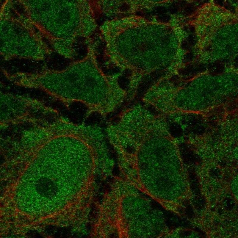 Staining of human cell line CACO-2 shows localization to nucleoplasm & plasma membrane.