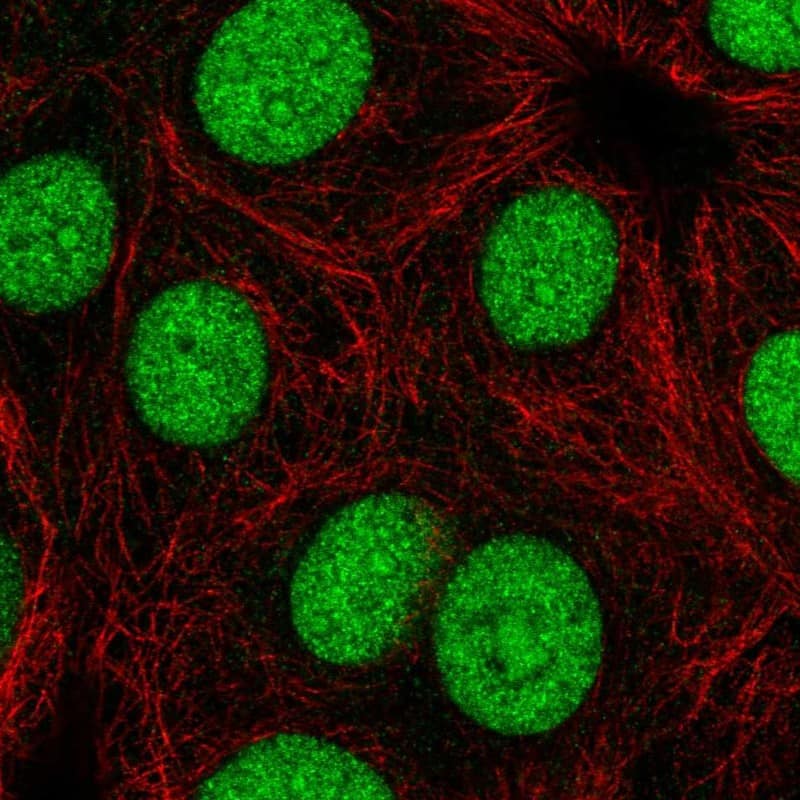 Staining of human cell line MCF-7 shows localization to nucleoplasm & nucleoli.
