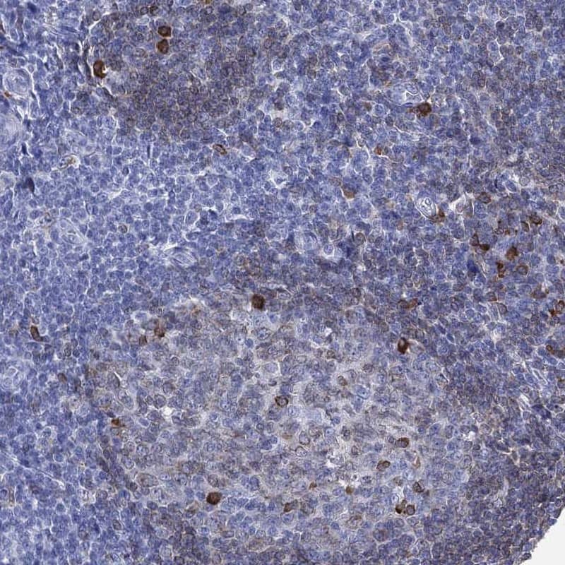 Staining of human tonsil shows strong cytoplasmic positivity in germinal center cells and non-germinal center cells.