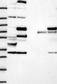Lane 1: Marker [kDa] 250,130,95,72,55,36,28,17,10Lane 2: RT-4Lane 3: U-251MGLane 4: Human PlasmaLane 5: LiverLane 6: Tonsil