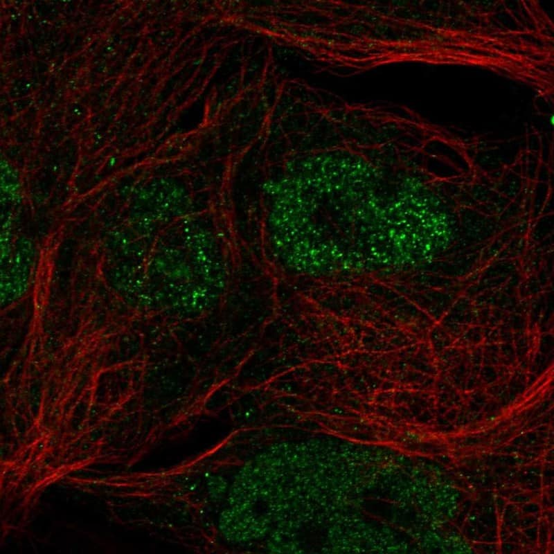 Staining of human cell line EFO-21 shows localization to nucleoplasm.