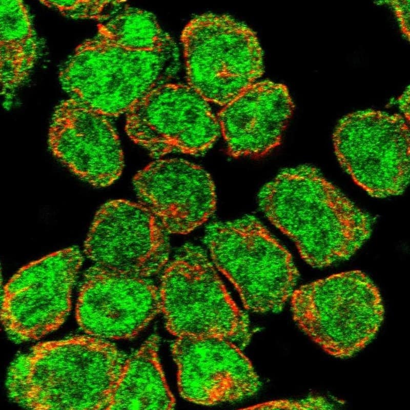 Staining of human cell line HEL shows localization to nucleoplasm & cytosol.