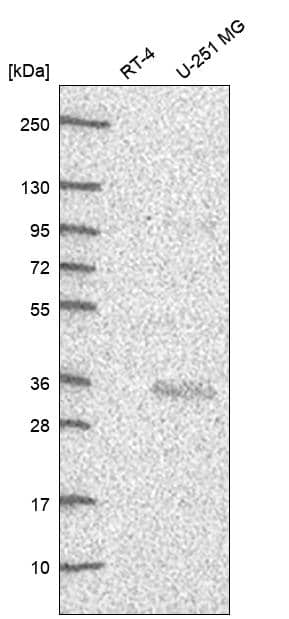 Analysis in human cell line RT-4 and human cell line U-251 MG.