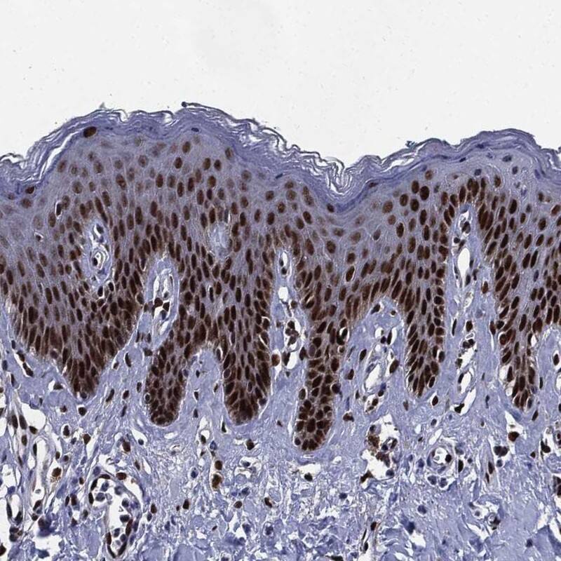 Staining of human skin shows nuclear positivity in epidermal cells.