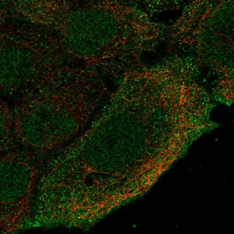 Staining of human cell line HaCaT shows localization to nucleoplasm & plasma membrane.