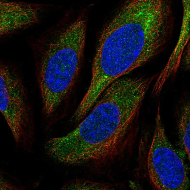 Staining of human cell line SiHa shows localization to cytosol.