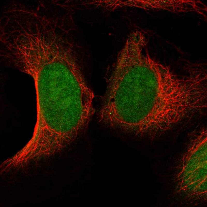 Staining of human cell line U2OS shows localization to nucleoplasm & vesicles.