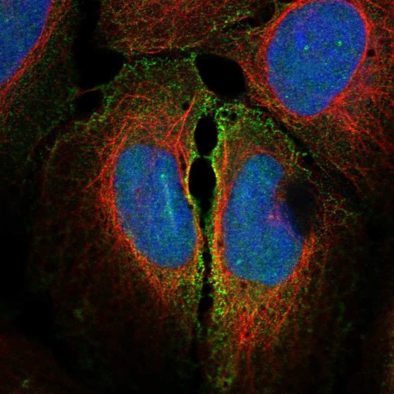 Staining of human cell line U2OS shows localization to nucleoplasm & plasma membrane.