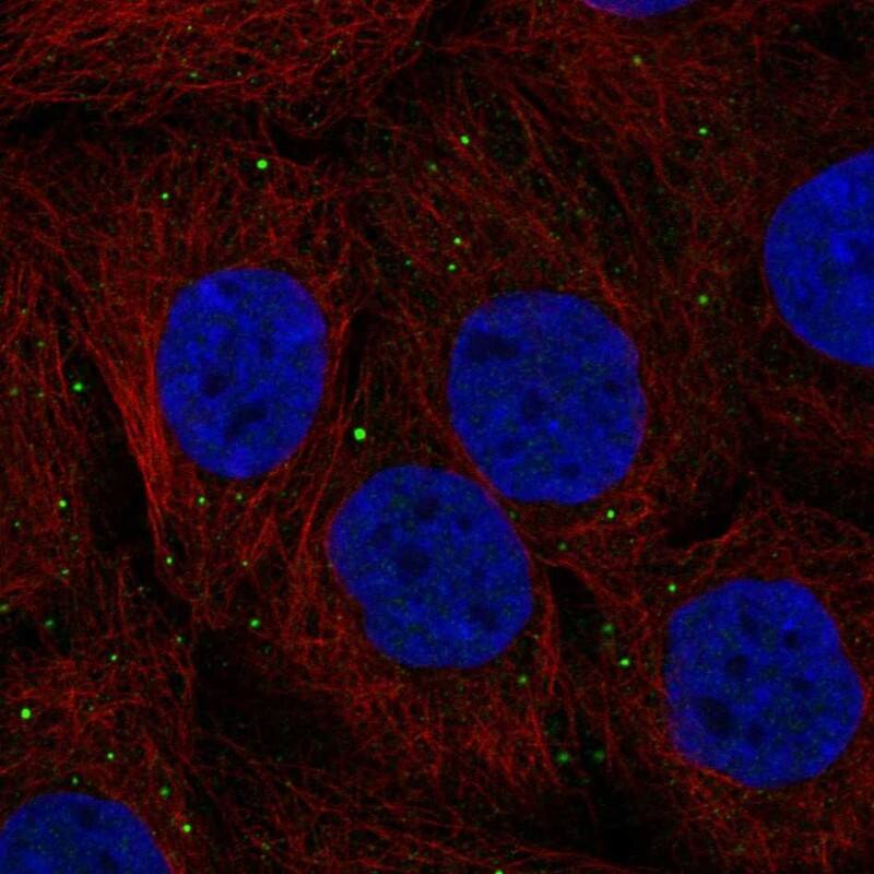 Staining of human cell line HaCaT shows localization to vesicles.
