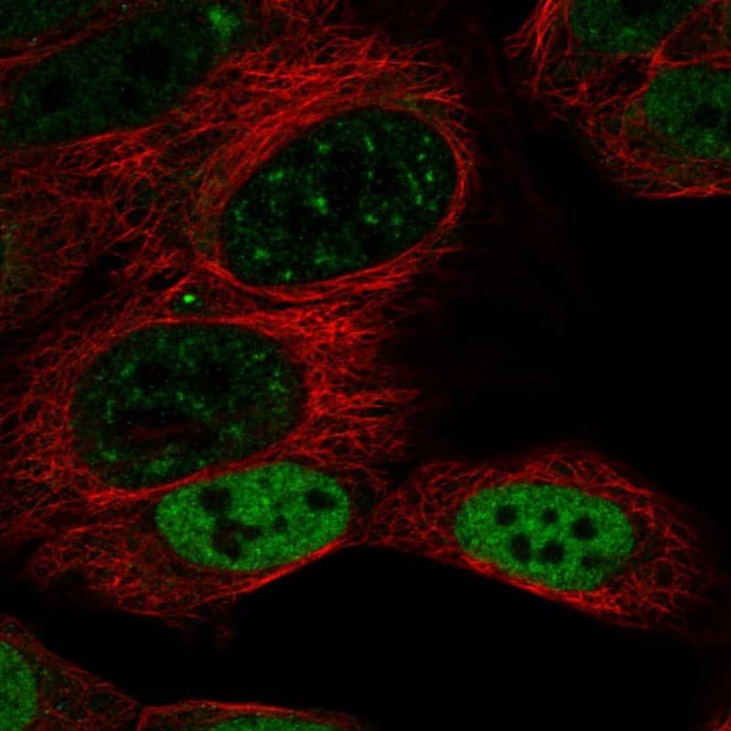 Staining of human cell line HAP1 shows localization to nucleoplasm & nuclear speckles.