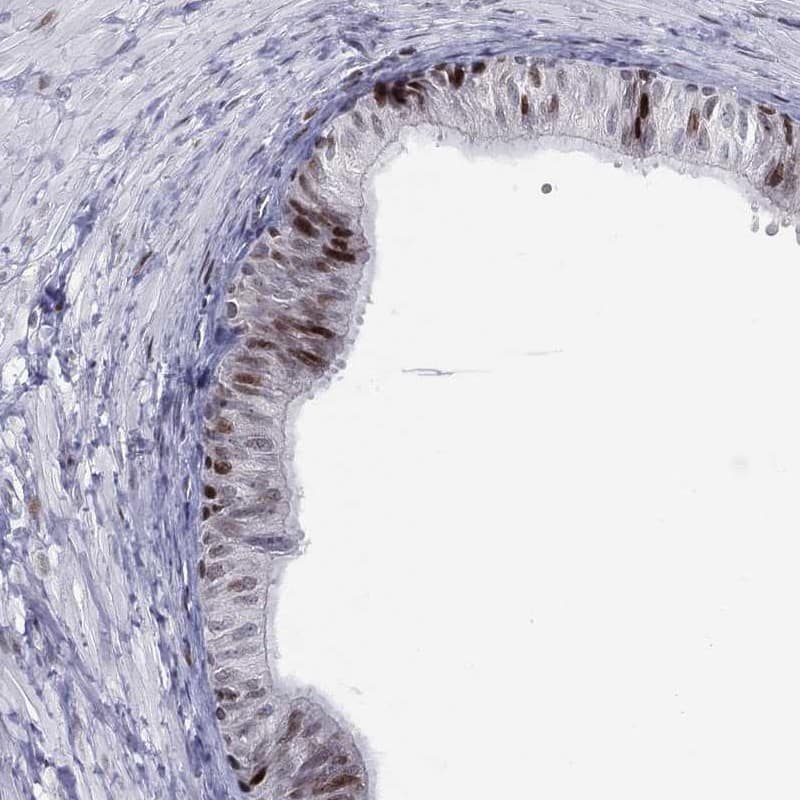 Staining of human epididymis shows strong nuclear positivity in glandular cells.