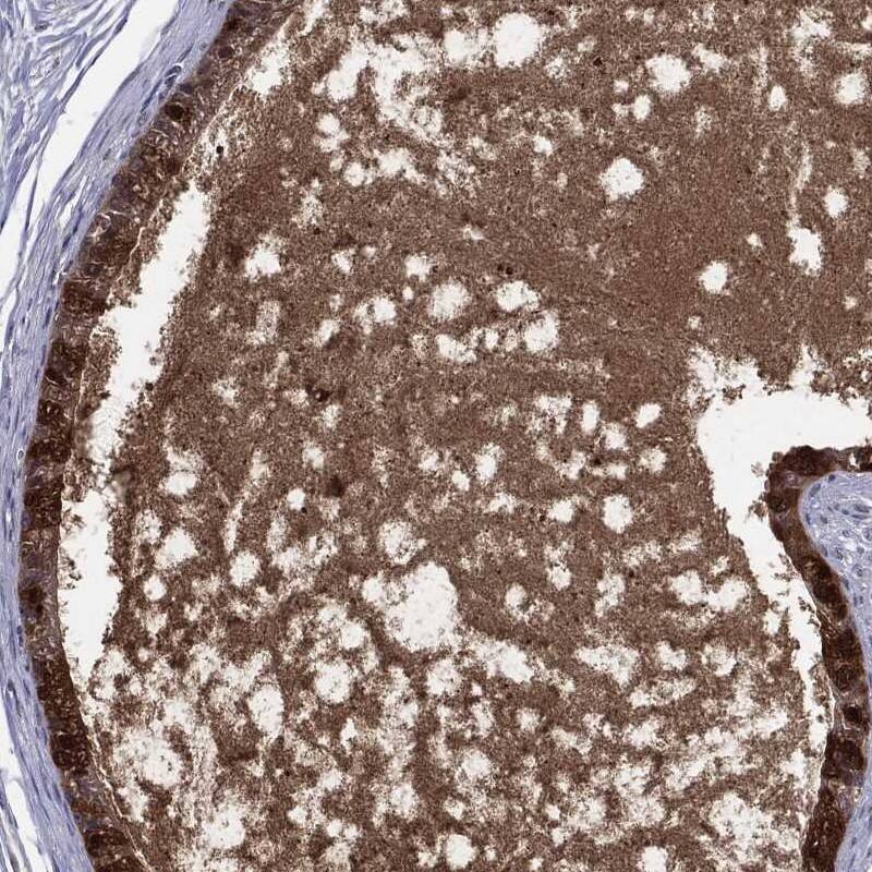 Staining of human epididymis shows strong cytoplasmic and secreted positivity in glandular cells.