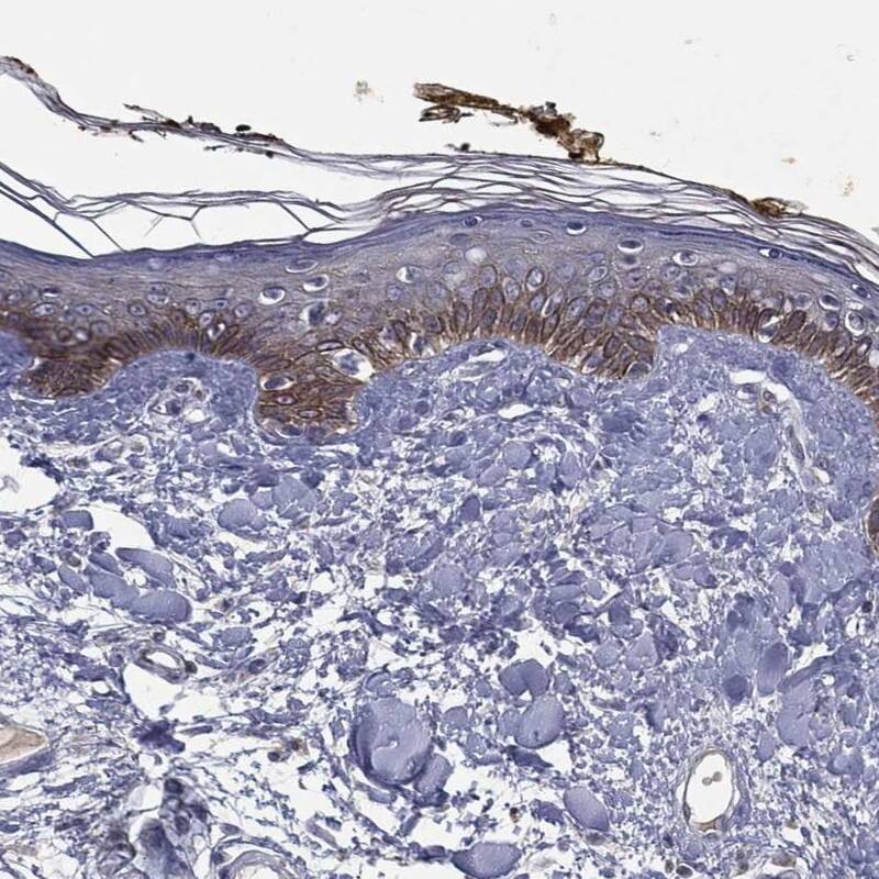 Staining of human skin shows moderate cytoplasmic positivity in keratinocytes.