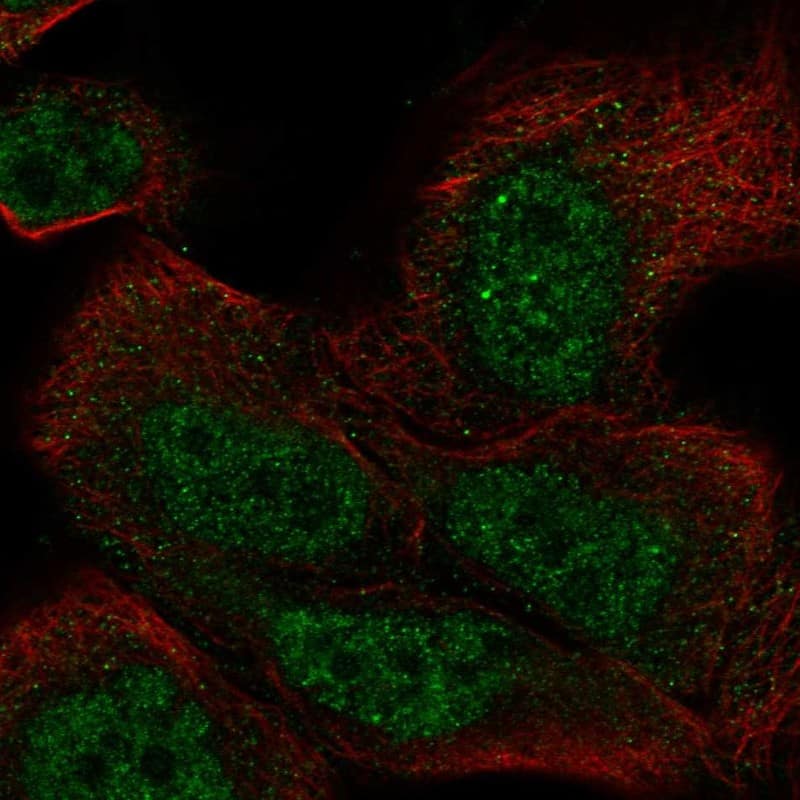 Staining of human cell line EFO-21 shows localization to nucleoplasm & cytosol.