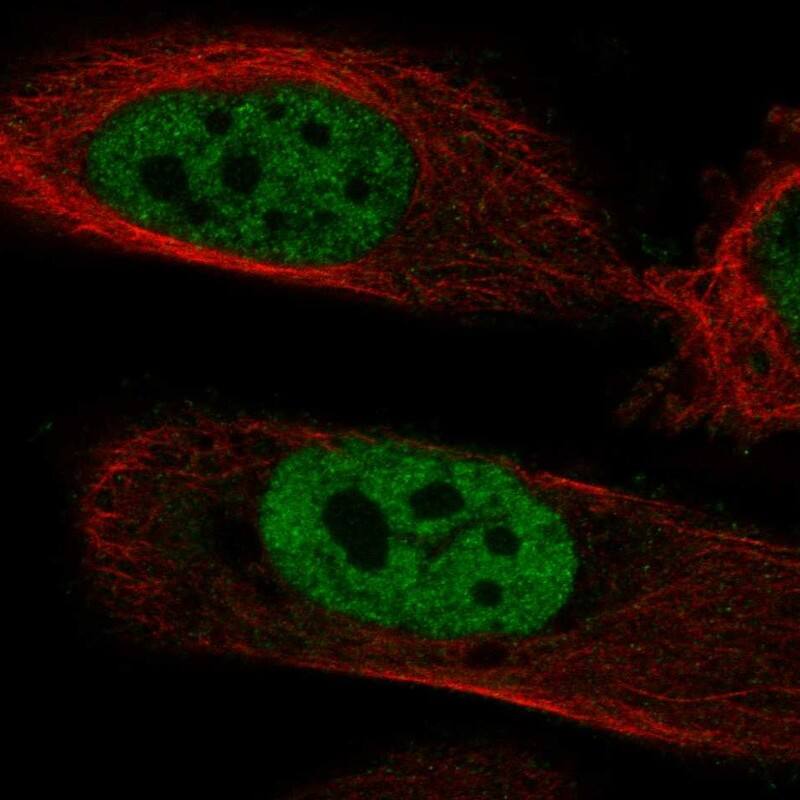 Staining of human cell line PC-3 shows localization to nucleoplasm.