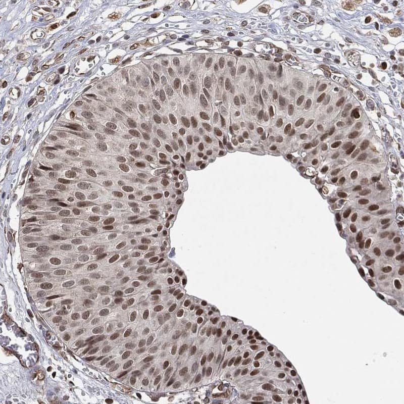 Staining of human urinary bladder shows nuclear positivity in urothelial cells.