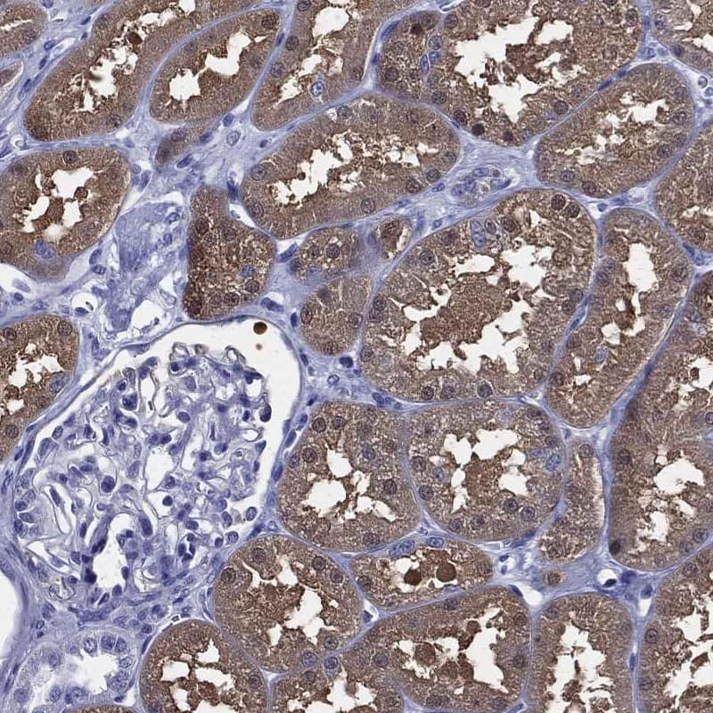 Staining of human kidney shows moderate cytoplasmic positivity in cell in proximal tubules.