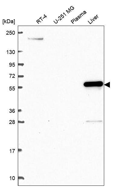 Analysis in human cell line RT-4, human cell line U-251 MG, human plasma and human liver tissue.