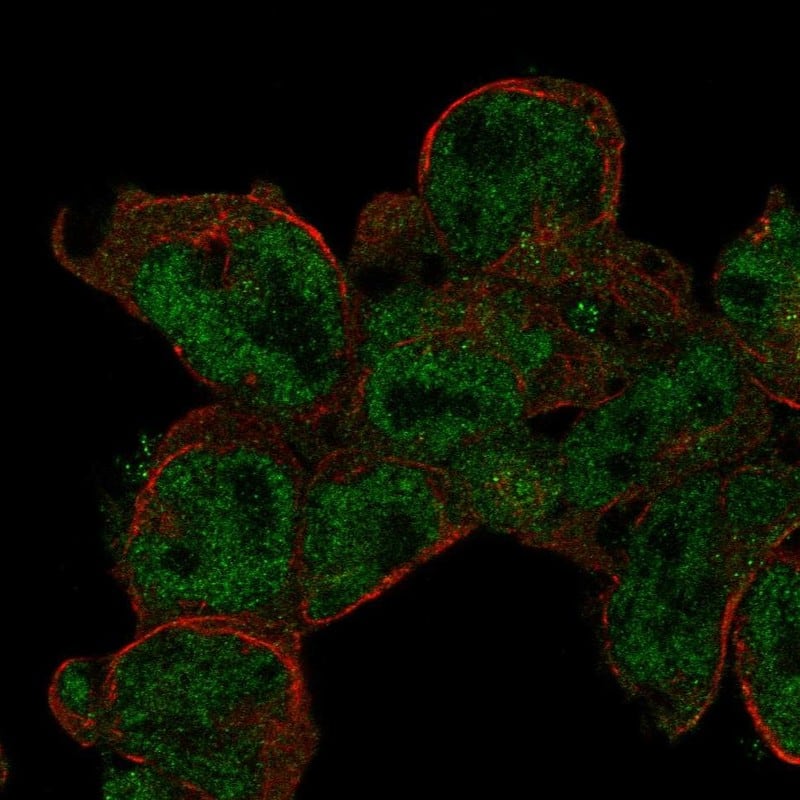 Staining of human cell line JURKAT shows localization to nucleoplasm.