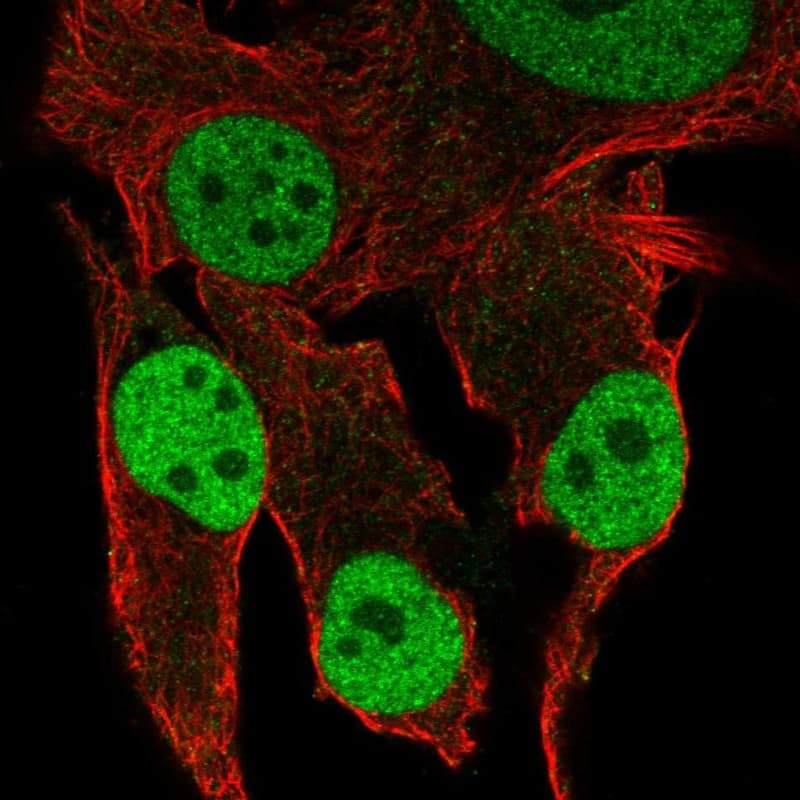 Staining of human cell line SK-MEL-30 shows localization to nucleoplasm.