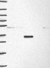 Lane 1: Marker [kDa] 250,130,95,72,55,36,28,17,10Lane 2: RT-4Lane 3: U-251MGLane 4: Human PlasmaLane 5: LiverLane 6: Tonsil