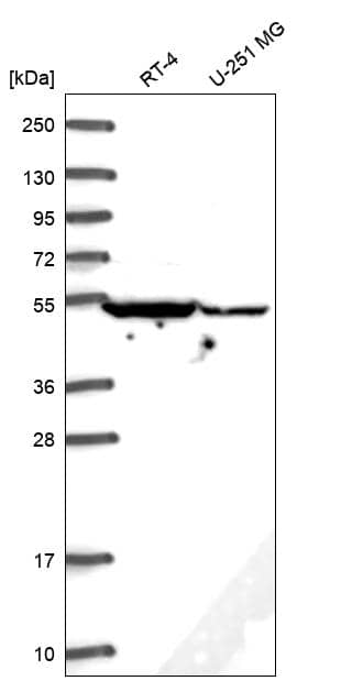 Analysis in human cell line RT-4 and human cell line U-251 MG.