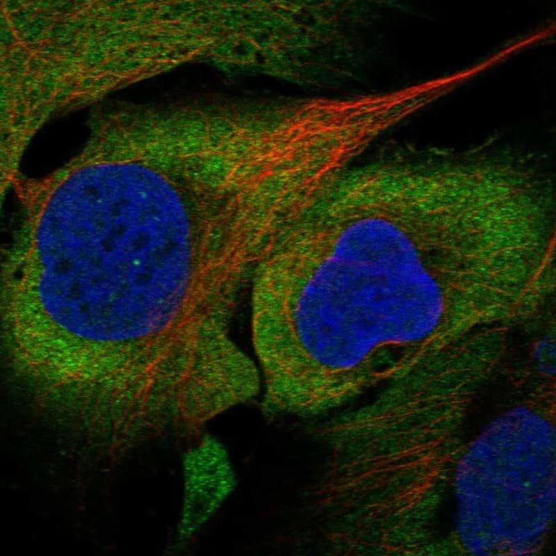 Staining of human cell line U2OS shows localization to cytosol.