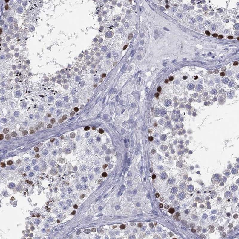 Staining of human testis shows strong nuclear positivity in cells in seminiferous ducts.