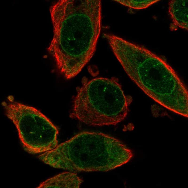 Staining of human cell line PC-3 shows localization to nuclear membrane & endoplasmic reticulum.