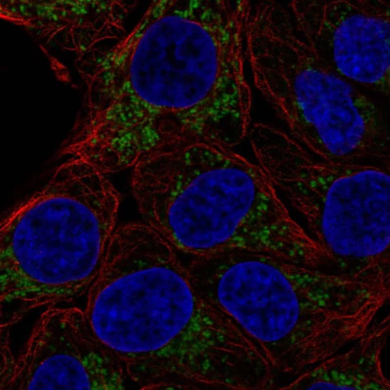 Staining of human cell line RT-4 shows localization to mitochondria.