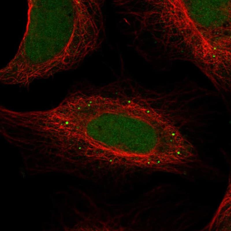 Staining of human cell line U2OS shows localization to nucleoplasm & vesicles.