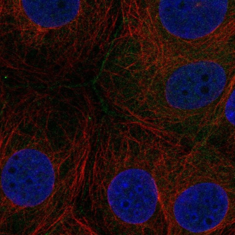 Immunocytochemistry/ Immunofluorescence FAM209A Antibody - BSA Free
