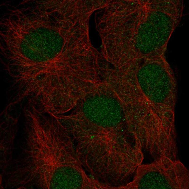 Staining of human cell line hTERT-RPE1 shows localization to nucleoplasm.