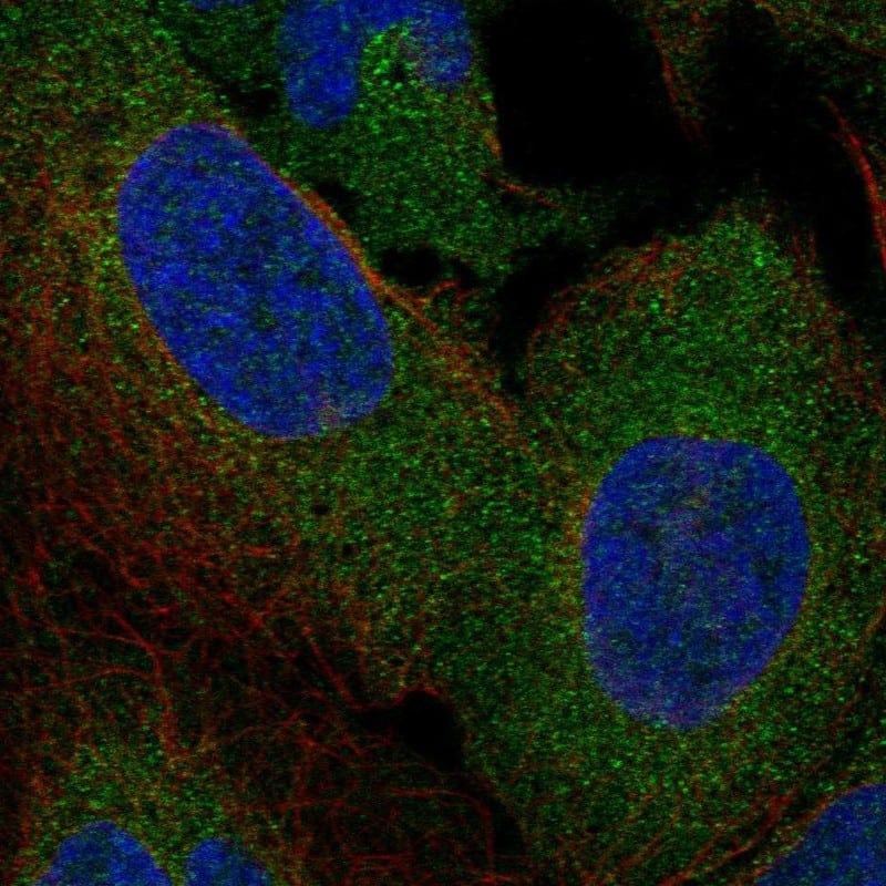 Staining of human cell line U2OS shows localization to cytosol.