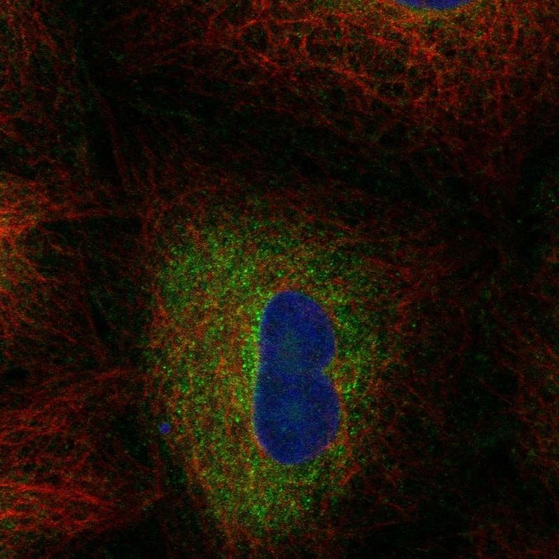 Staining of human cell line A-549 shows localization to plasma membrane & endoplasmic reticulum.