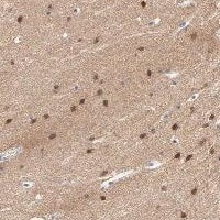 Immunohistochemistry-Paraffin FBXL5 Antibody