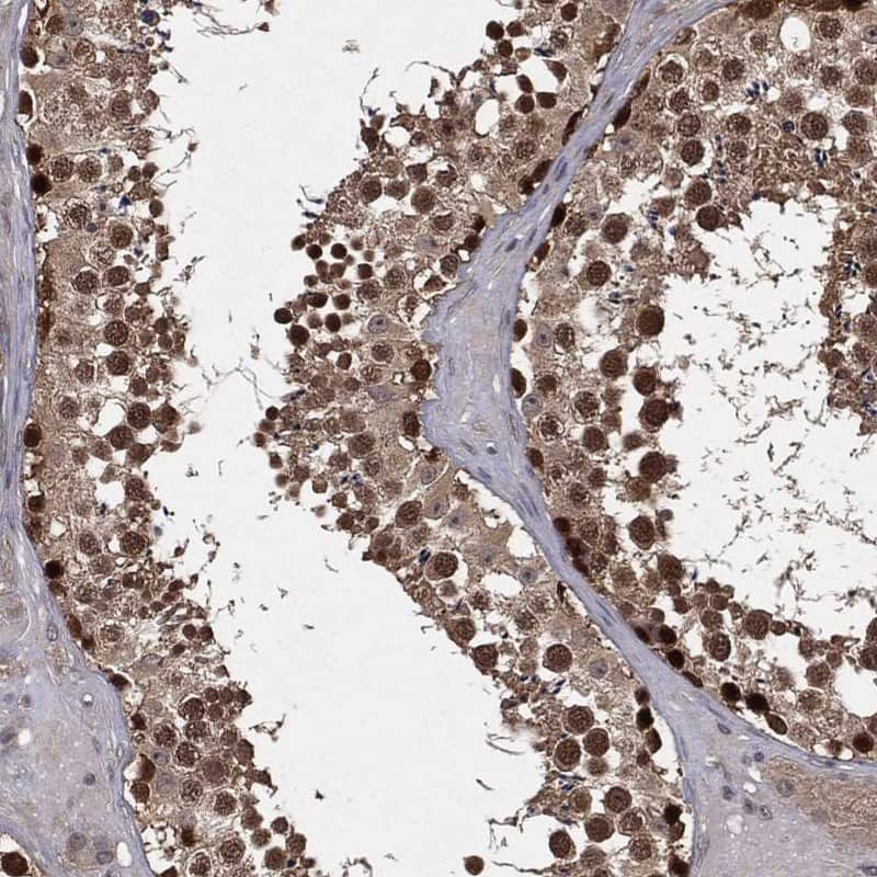 Staining of human testis shows strong nuclear positivity in cells in seminiferous ducts.