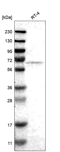 Analysis in human cell line RT-4.