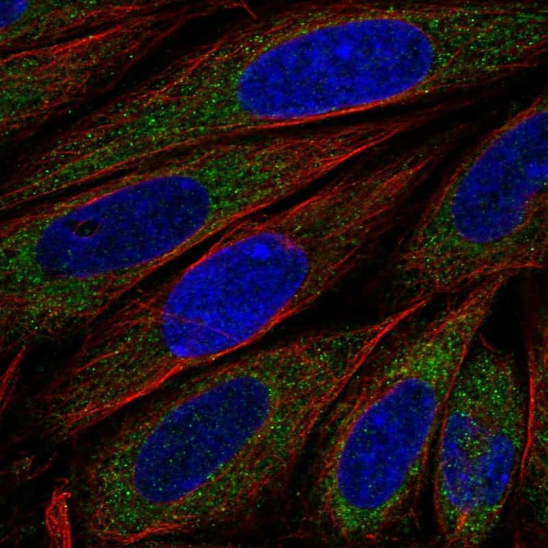 Staining of human cell line SiHa shows localization to cytosol.